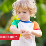 Why do mosquito bites itch? - Pest control services in South Florida by Petri Pest Control